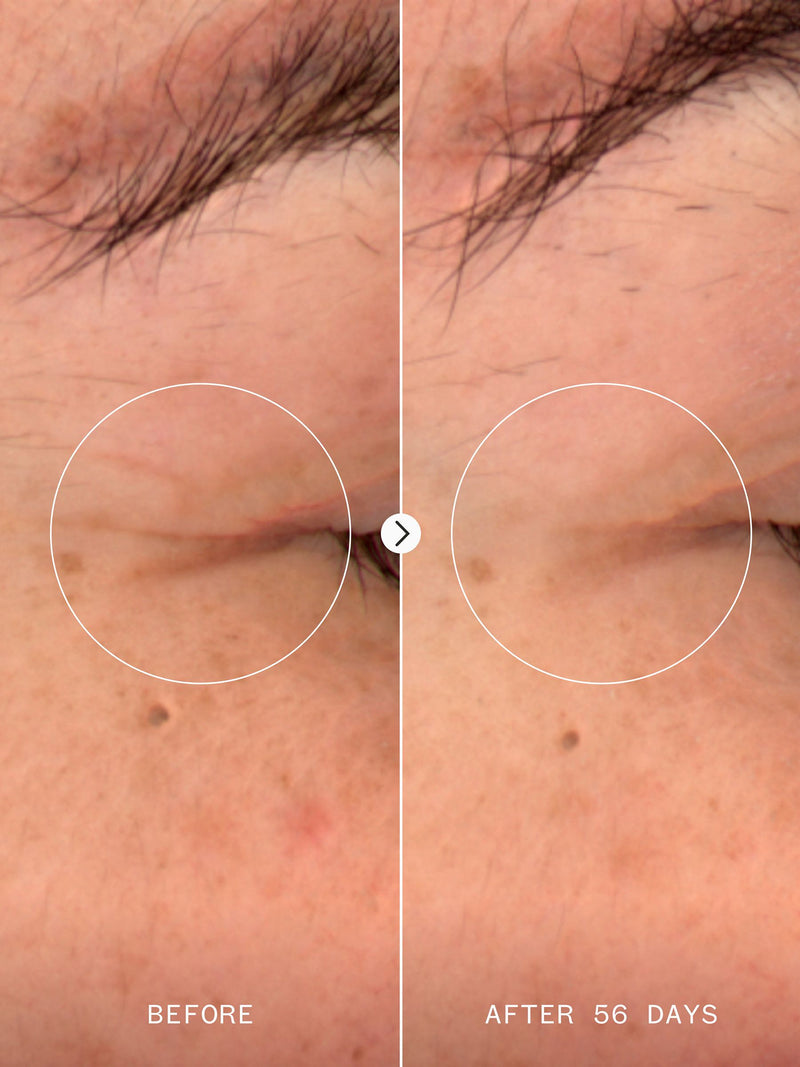 Pai Skincare NAD+ Serum (British brand)