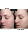Kate Somerville DeliKate Recovery Serum 30 ml - British product