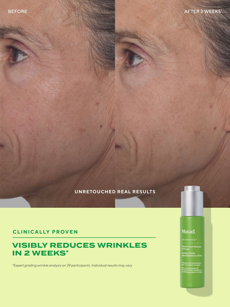 Murad Retinol Youth Renewal Oil Drops 30ml