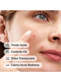 The Ordinary Sulfur 10% powder-to-cream concentrate 5g, imported from the UK