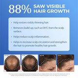 BosleyMD BOSRevive Starter Pack For Non Color-Treated Hair 60g