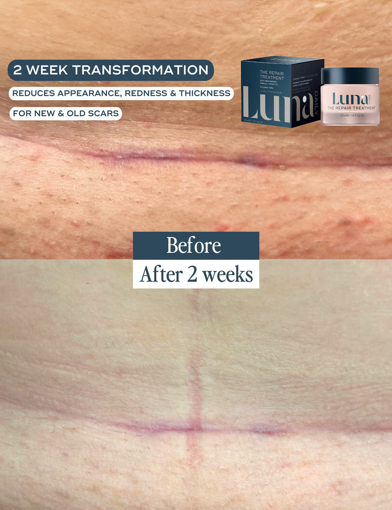 Scar treatment serum-gel 50ml, imported from the UK