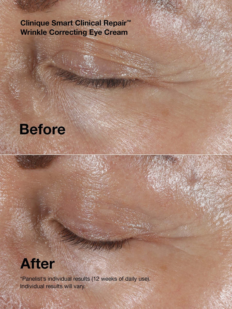 Clinique Smart Clinical Repair anti-aging mini kit (British brand)