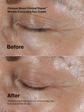 Clinique Smart Clinical Repair anti-aging mini kit (British brand)