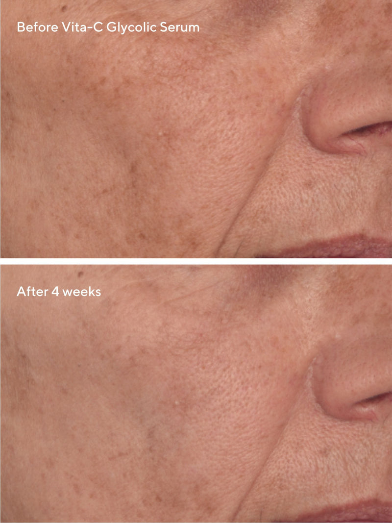 Murad Radiant Skin Discovery Kit, imported from the UK
