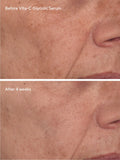 Murad Radiant Skin Discovery Kit, imported from the UK