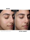 Kate Somerville Pore-fect Skin Edit travel kit - British product