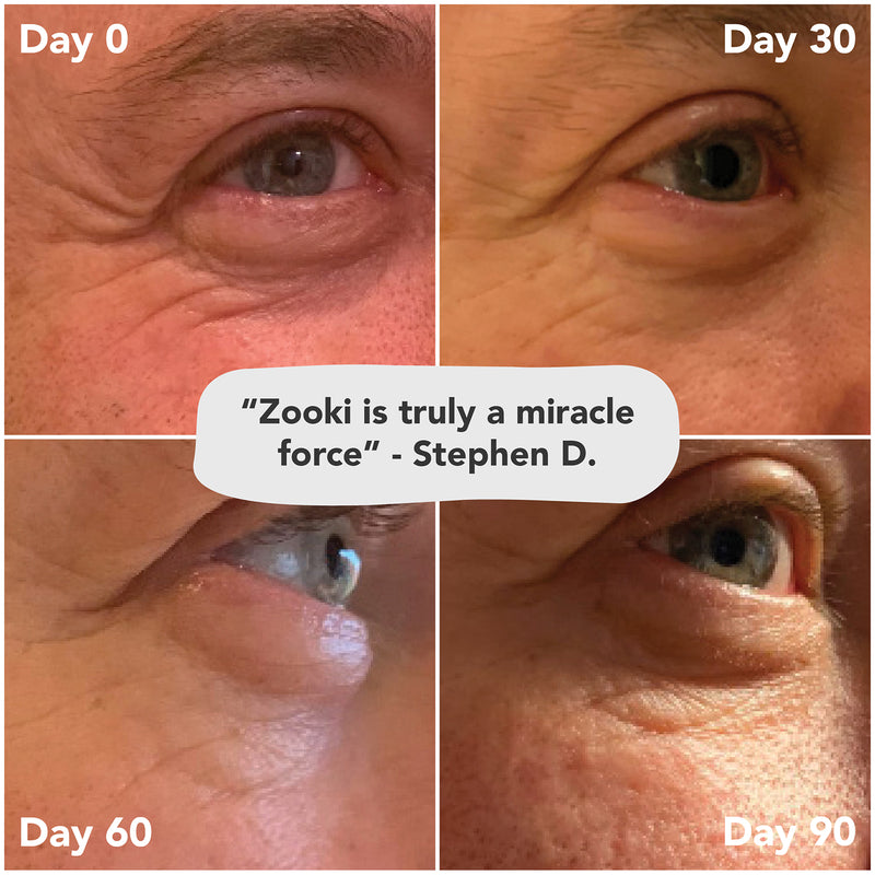 Zooki marine collagen supplement blackcurrant 30 sachets, UK version