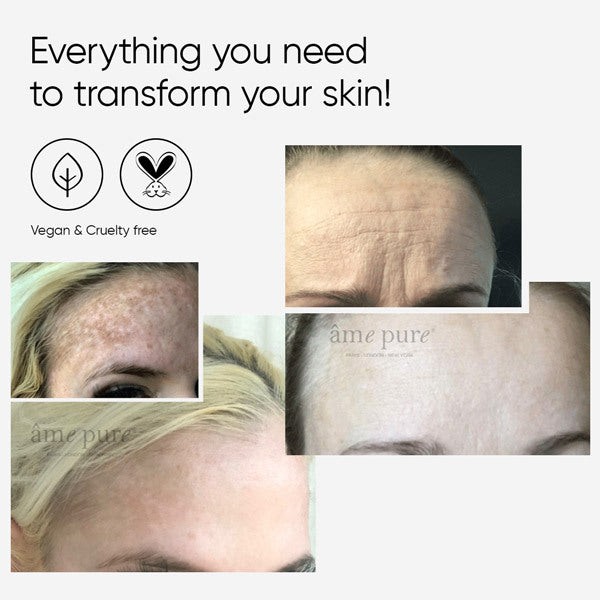 âme pure dermaroller kit BASIC 0.5mm 30ml - British product