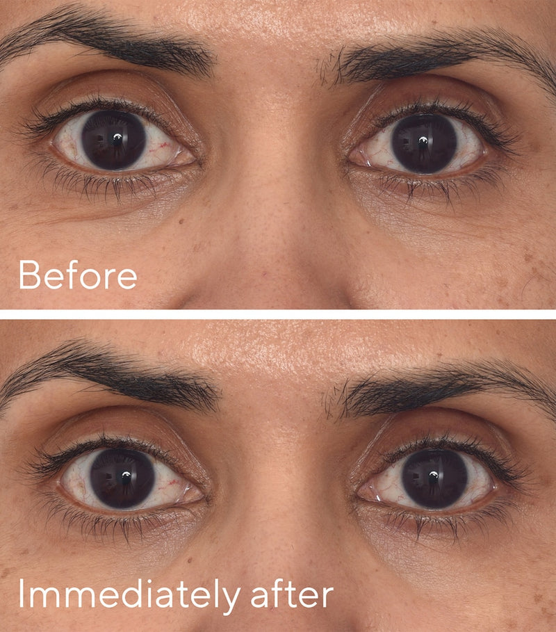 Murad Retinol Youth Renewal Eye Mask Pack of 5, imported from the UK