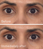 Murad Retinol Youth Renewal Eye Mask Pack of 5, imported from the UK