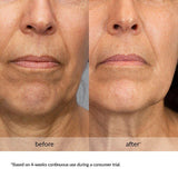 Avon Anew Platinum Lift & Tighten Serum - McGrocer