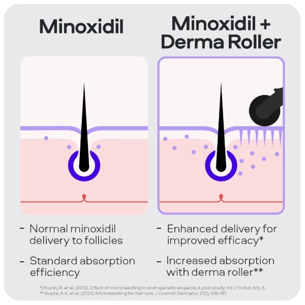Sons Minoxidil, DHT shampoo and dermaroller set, imported from the UK
