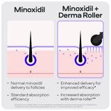 Sons Minoxidil, DHT shampoo and dermaroller set, imported from the UK