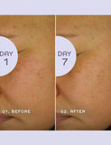 Bio Retinoid Youth Serum 30ml - McGrocer