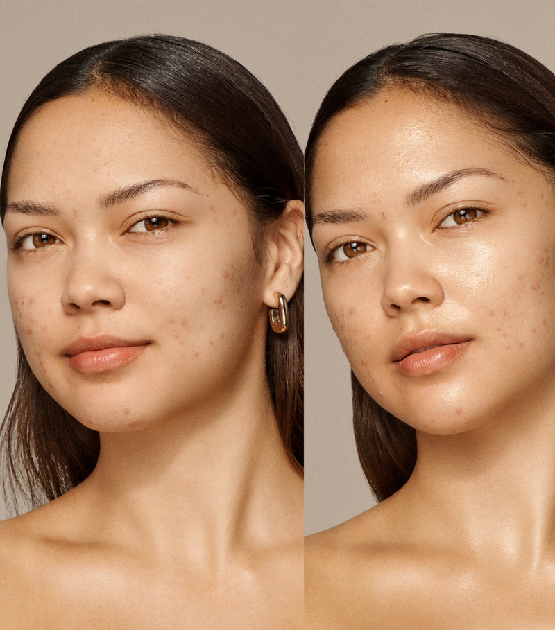 VIEVE Skin Nova XL skincare duo (British brand)