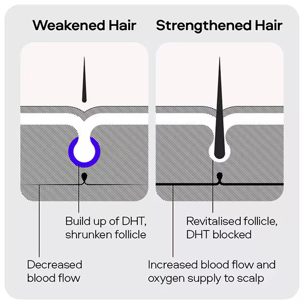 Sons Minoxidil hair regrowth solution 5% (British brand)