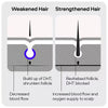 Sons Minoxidil hair regrowth solution 5% (British brand)