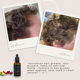 Obvs Skincare Organic Scalp Oil, UK version