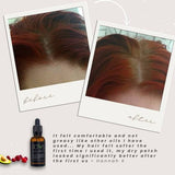 Obvs Skincare Organic Scalp Oil, UK version