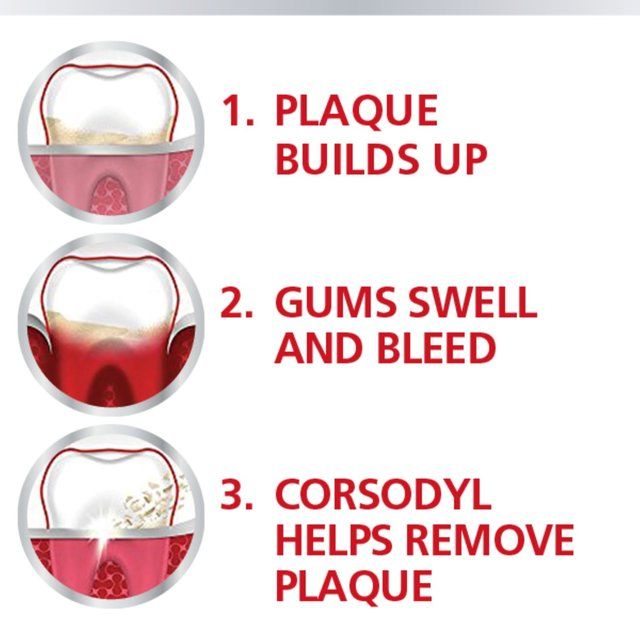 Corsodyl Gum Mouthwash Original Alcohol Free Antibacterial 300ml
