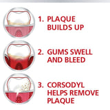 Corsodyl Gum Mouthwash Original Alcohol Free Antibacterial 300ml