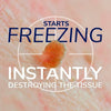 Scholl Freeze Away Skin Tag Remover 1 unit (British brand)