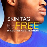 Scholl Freeze Away Skin Tag Remover 1 unit (British brand)