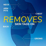 Scholl Freeze Away Skin Tag Remover 1 unit (British brand)