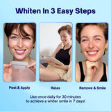 MySweetSmile teeth whitening strips 21 treatments imported from the UK