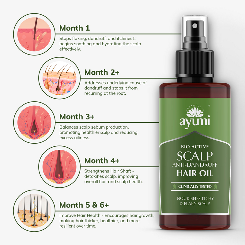 Ayumi anti-dandruff scalp hair oil 100ml, UK version