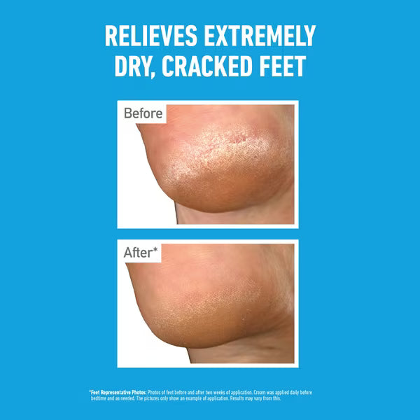 O'keeffe's Healthy Feet Overnight Cream 80ml, imported from the UK