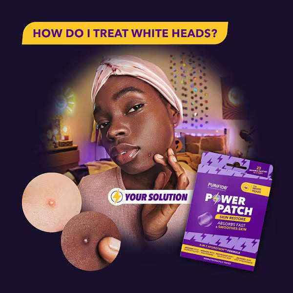 Acnecide Purifide whitehead patches 23ct, imported from the UK