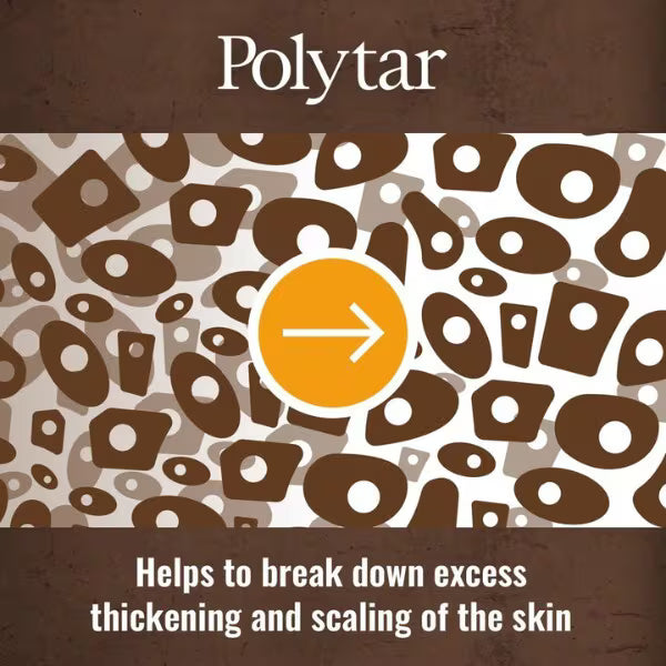 Polytar Medicated Scalp Shampoo Antiseptic 150ml, imported from the UK