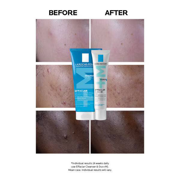 La Roche-Posay Effaclar Duo+M Anti-Breakout Gel Moisturiser - British product