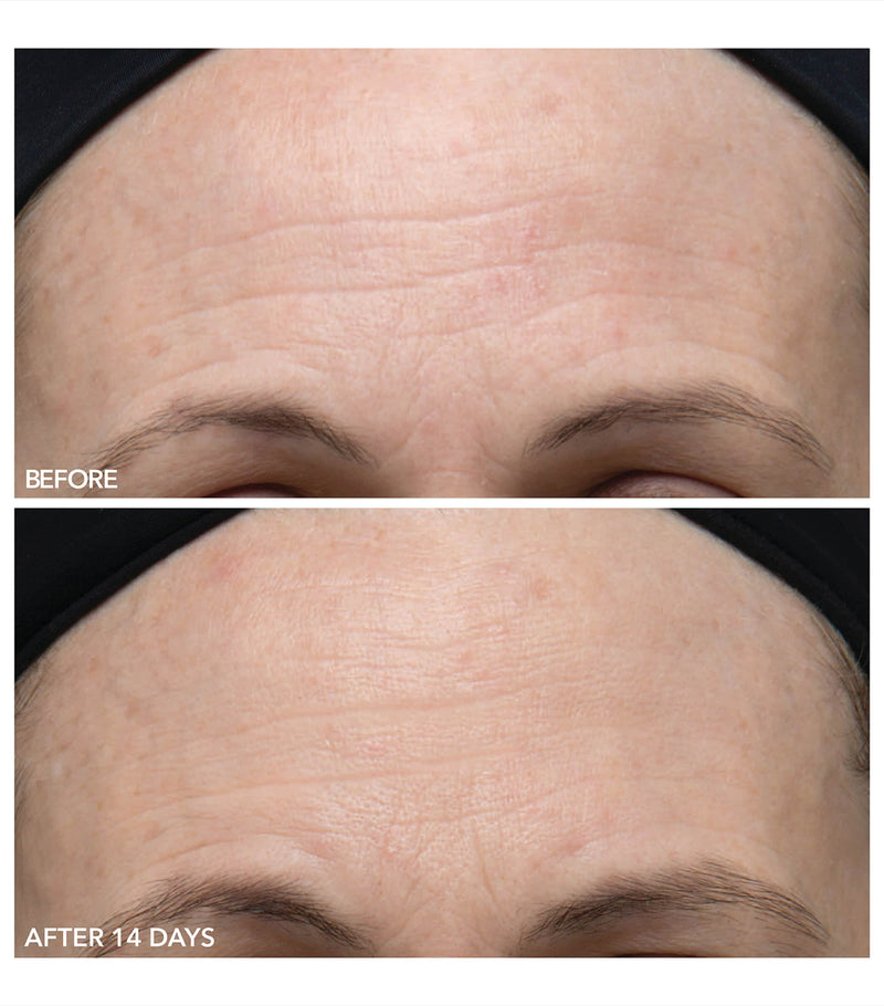 Dr Dennis Gross gentle peel sensitive skin 5 treatments - British product
