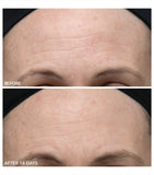 Dr Dennis Gross gentle peel sensitive skin 5 treatments - British product
