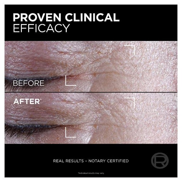 L'Oréal Paris Age Perfect Cell Renew Midnight Eye Cream 15ml, UK version
