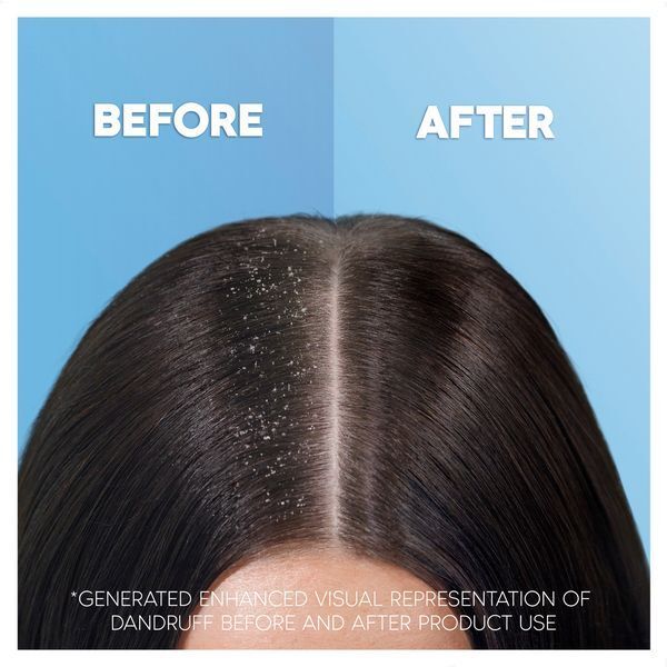 Head & Shoulders Itchy Scalp Shampoo, 400Ml