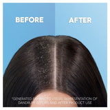 Head & Shoulders Itchy Scalp Shampoo, 400Ml