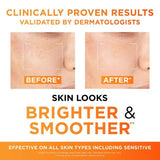 L'Oreal Paris Revitalift Clinical 12% Pure Vitamin C Brightening Serum 30ml