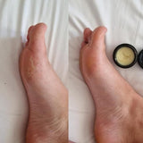 Obvs Skincare Organic Balm For Lips, Nips and Dry Bits 15ml