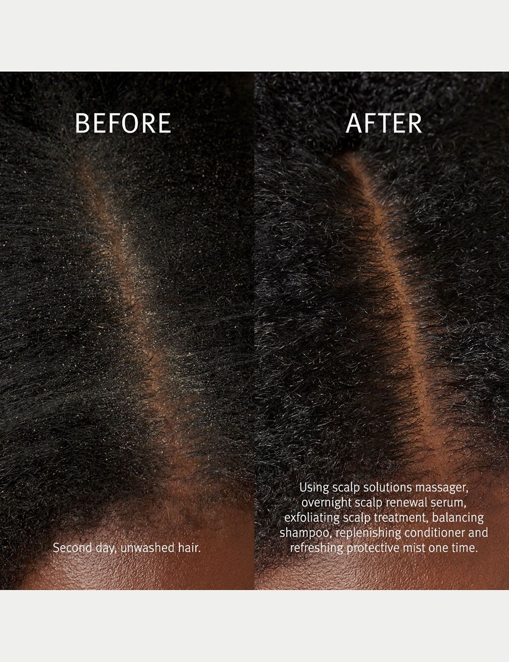 Scalp Solutions Overnight Scalp Renewal Serum (with hyaluronic acid) 50ml