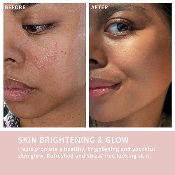 SENSSE LED Light Therapy Mask