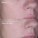 Skin Republic Niacinamide 10% + Zinc 1% Serum 30g