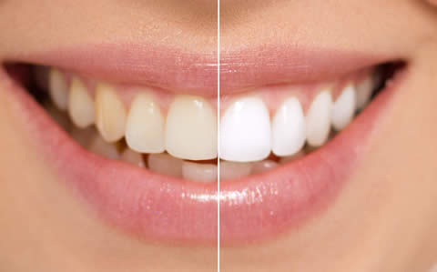 Illuminate Your Smile: 10 Best Whitening Toothpastes for a Radiant Grin