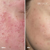 Fragrance Free Mild Facial Exfoliant with Dead Sea Minerals
