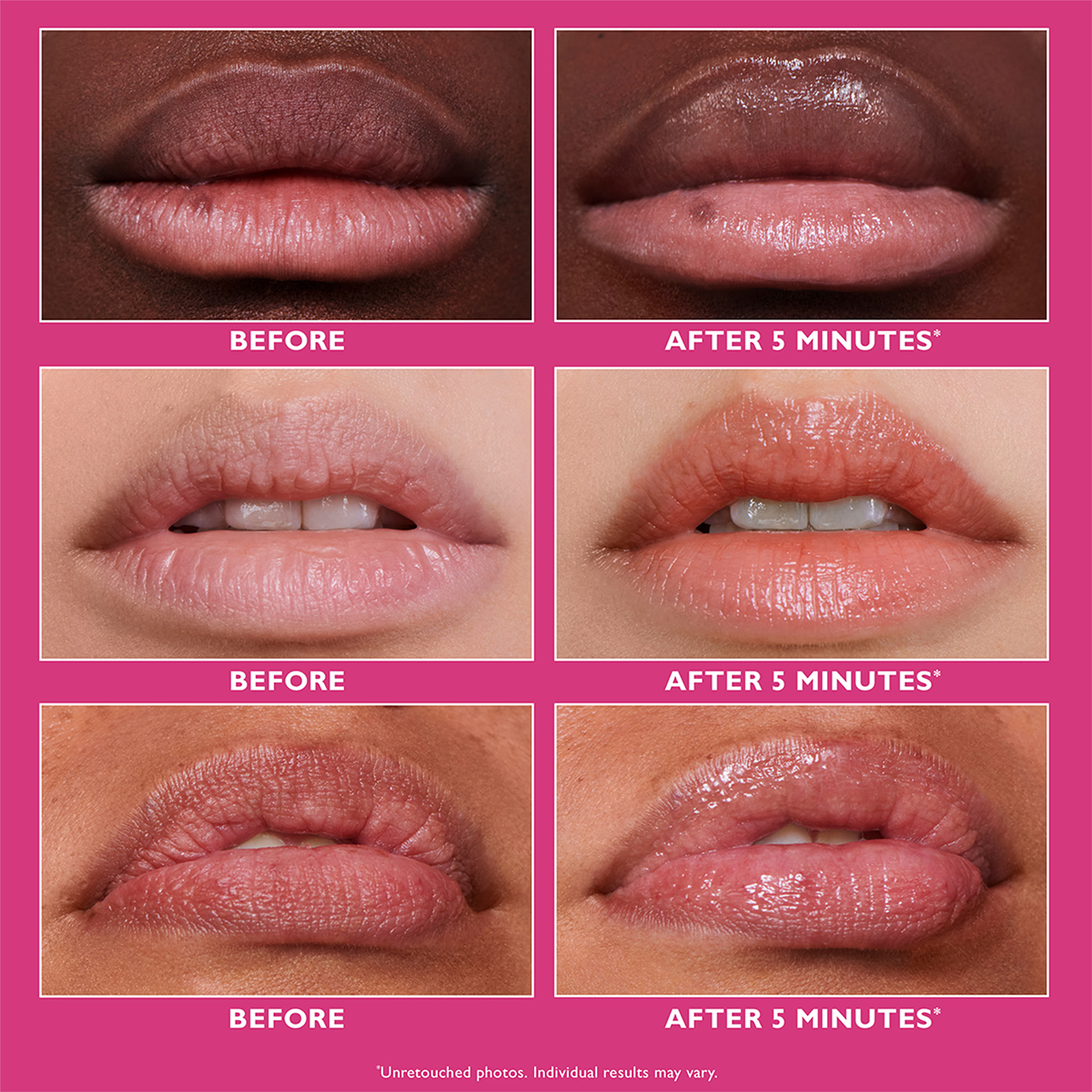 Peter Thomas Roth Instant Firmx Lip Filler 10ml (British brand)