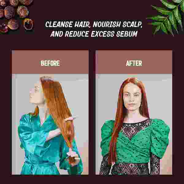 AyurVita Neem and Reetha Shampoo 300ml - British product