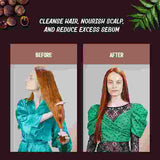 AyurVita Neem and Reetha Shampoo 300ml - British product